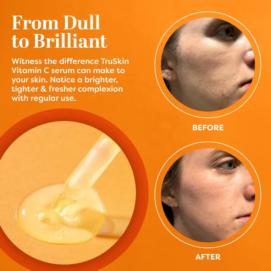 The Benefits of TruSkin Vitamin C Serum for Youthful Skin